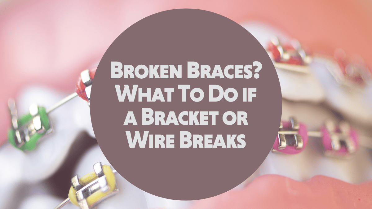 Broken Braces What To Do if a Bracket or Wire Breaks