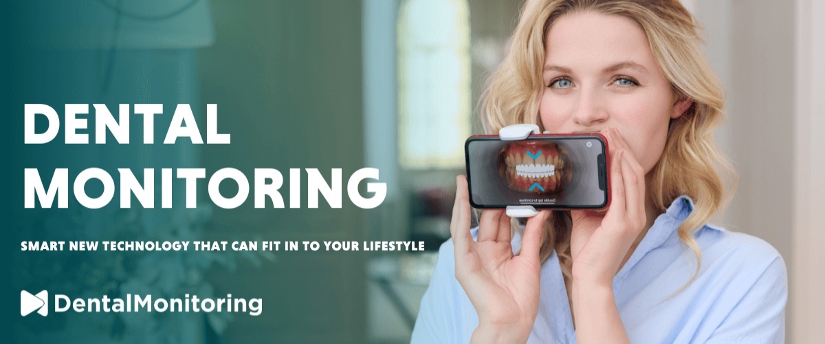 Dental Monitoring