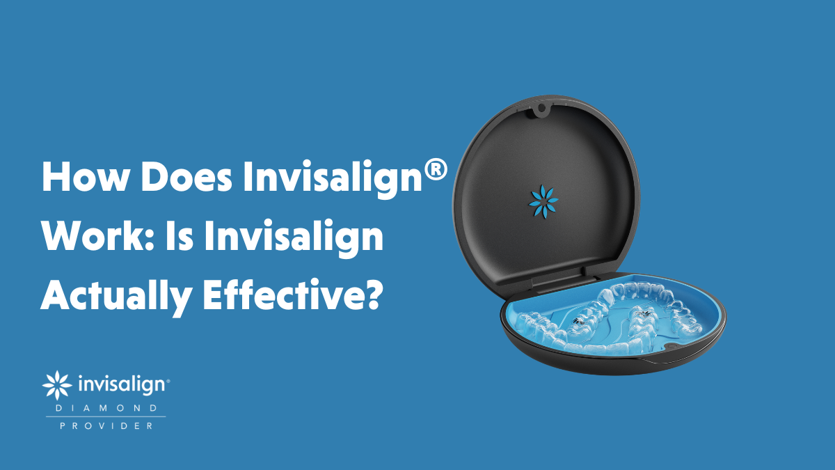 How Does Invisalign® Work & Is Invisalign Actually Effective?