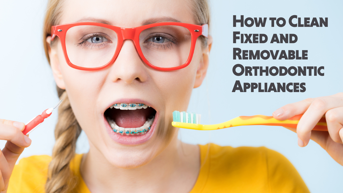 How to Clean Braces the Right Way 👍️