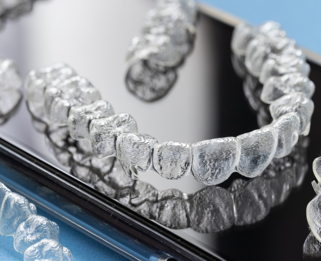 Invisalign Aligner