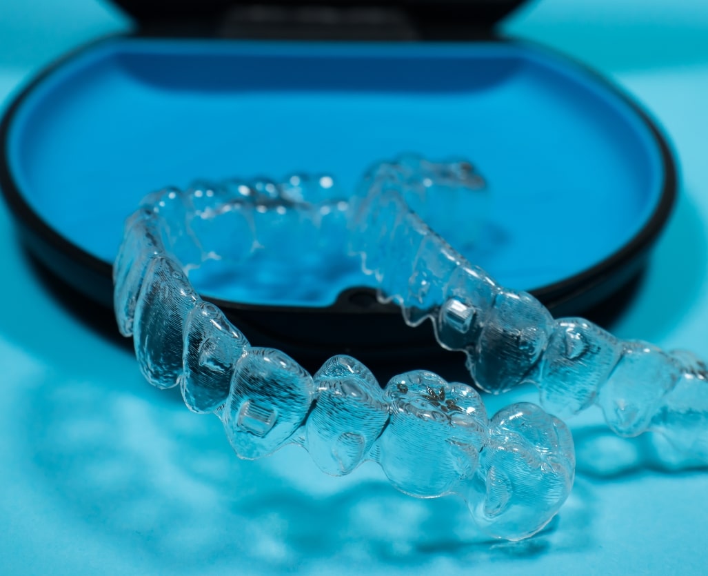 Invisalign Aligners in Case