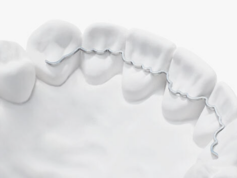 Retainers After Braces Keep Your Smile Straight Park Orthodontics