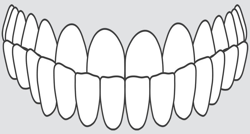 crooked teeth under bite