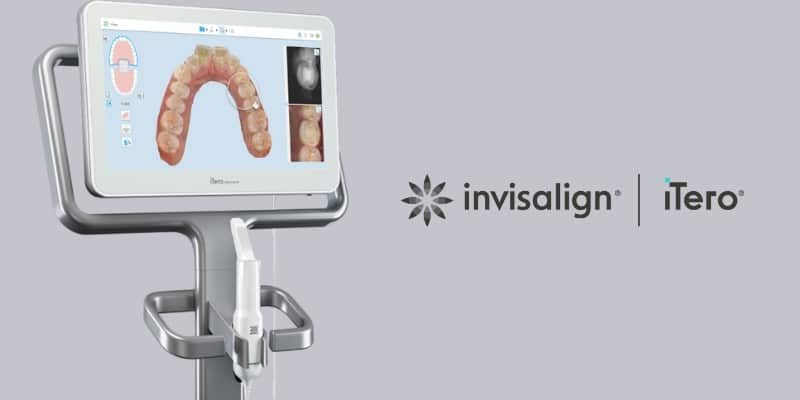 Invisalign Itero