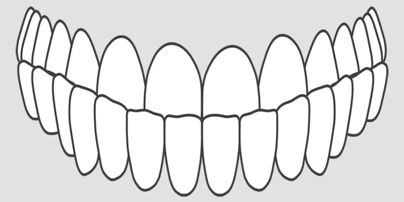 crooked teeth under bite